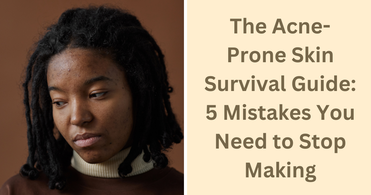 The Acne-Prone Skin Survival Guide: 5 Mistakes You Need to Stop Making