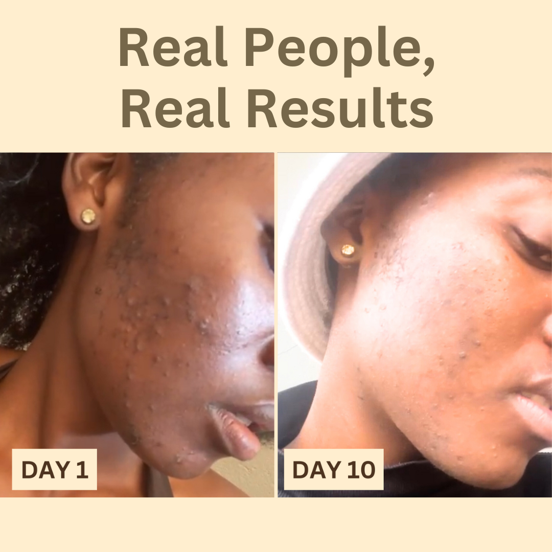 Skin Remedy - Before/After