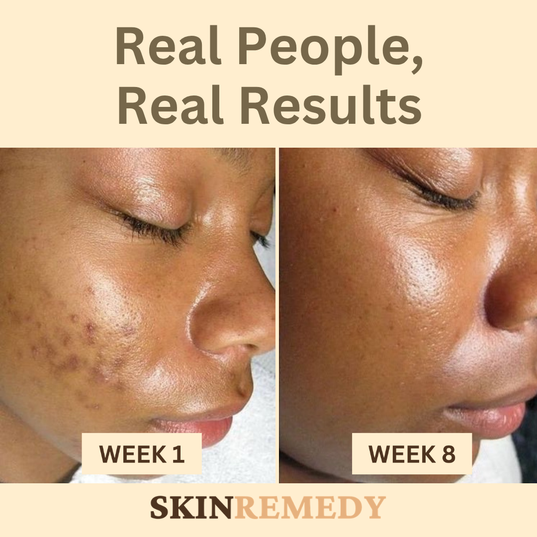 Dark Spot Corrector Serum