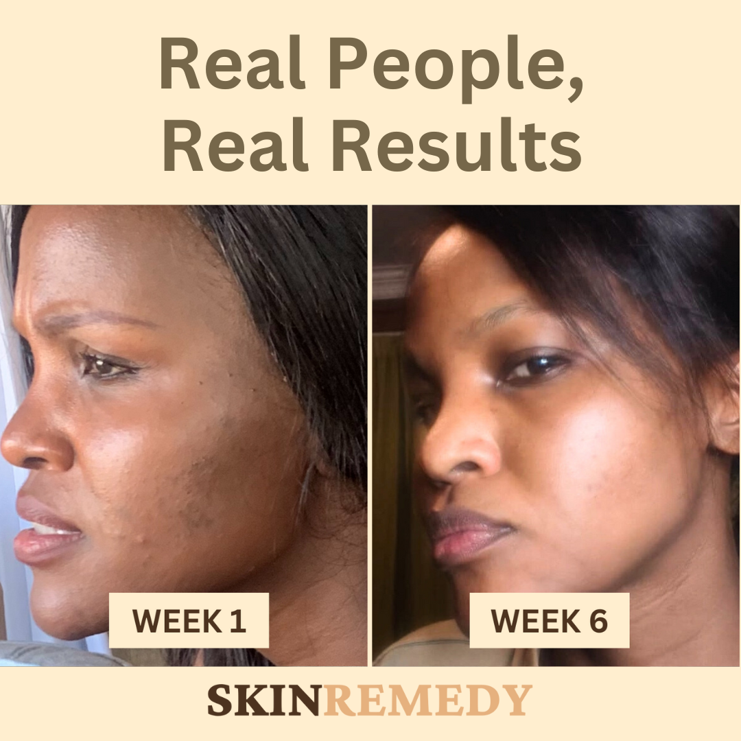 Skin Remedy - Before/After