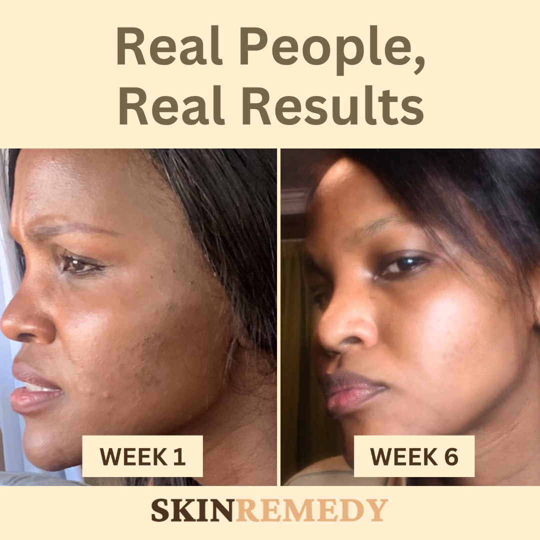 Dark Spot Corrector Serum